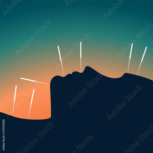 Acupuncture banner with woman face silhouette and chinese needles. Alternative medicine and treatment poster template. Medical vector eps illustration