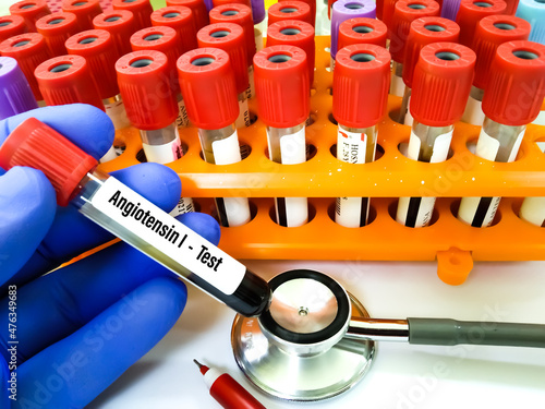 Blood sample tube for Angiotensin I test. To diagnosis and monitor sarcoidosis at medical laboratory. Test tube and pen background photo