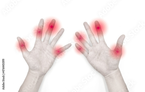 фотографія Finger joints inflammation