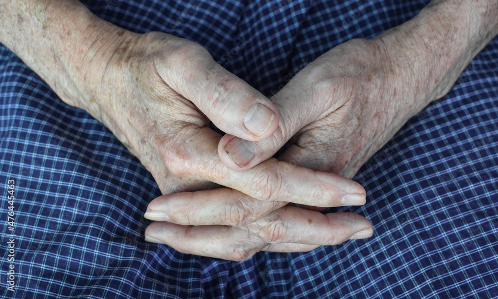 Clasped hands of Asian man. Concept of rheumatoid arthritis, osteoarthritis or joint pain. Clasped hands of Asian man. Concept of rheumatoid arthritis, osteoarthritis or joint pain.