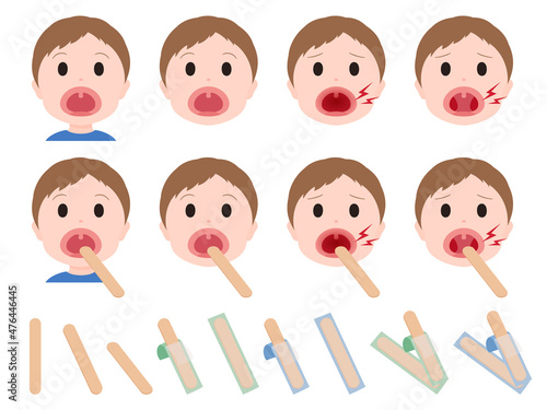 舌圧子と喉を診察する男の子のイラスト素材セット
