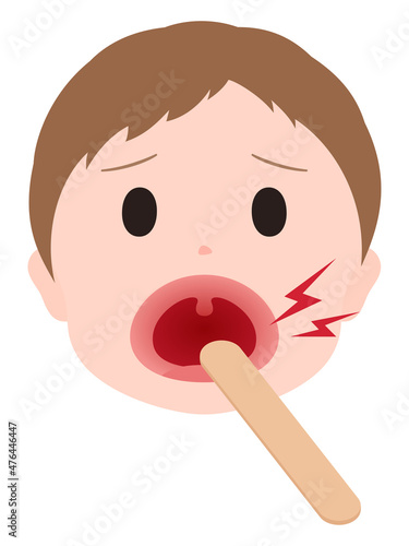 舌圧子で喉を診察する男の子のイラスト_痛い