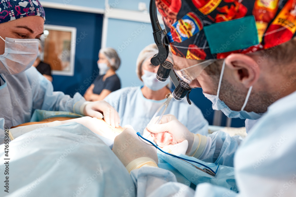A team of surgeons is fighting for life, for a real operation, for real emotions. The intensive care team is fighting for the life of the patient. Saving life, the struggle for life A team of surgeons is fighting for life, for a real operation, for real emotions. The intensive care team is fighting for the life of the patient. Saving life, the struggle for life