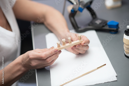 Close up picture of hands with dental prosthesis photo