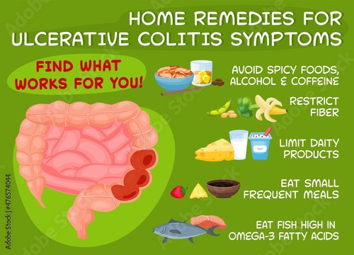Home remedies for ulcerative colitis, medical poster. Diet advice for cure UC. Vector illustration on green background
