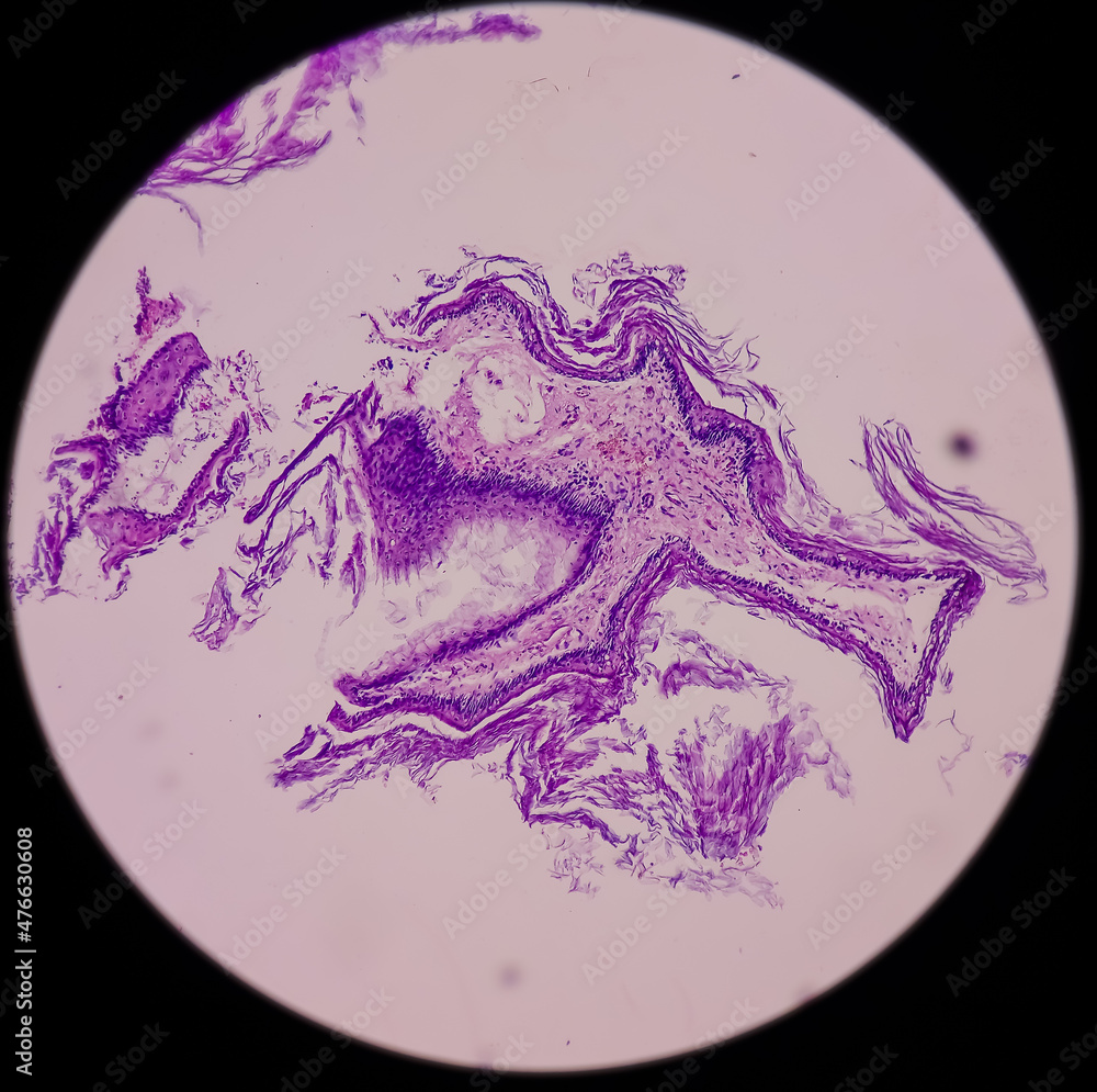 Zdjęcie Stock Ear and mastoid(biopsy) Microphotograph of