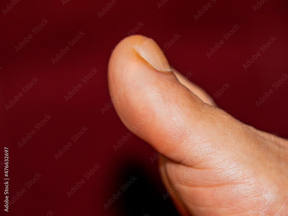 A big toe with a solid background A big toe with a solid background