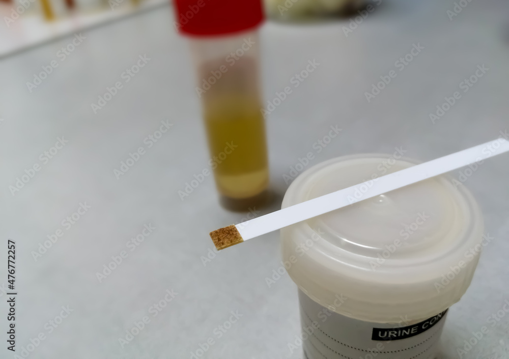 Testing strip and sample container isolated for urine glucose test