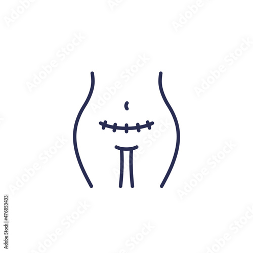 cesarean section, scar line icon