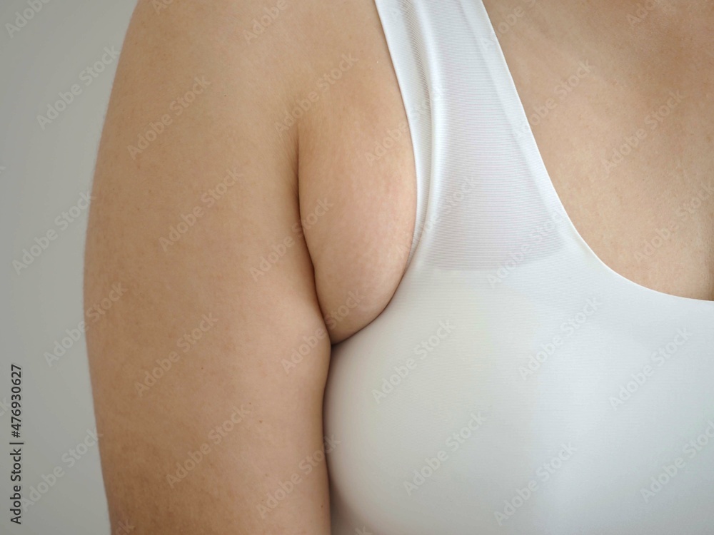 Fat woman armpit or underarm fat skin, woman diet lifestyle concept.  closeup photo, blurred. Stock Photo
