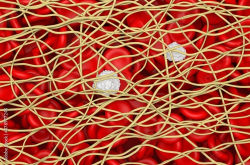 Blood clot. The red blood cells and white blood cells are trapped in filaments of fibrin protein. Isometric view 3d illustration photo