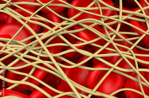 Blood clot. The red blood cells are trapped in filaments of fibrin protein. Isometric view 3d illustration photo