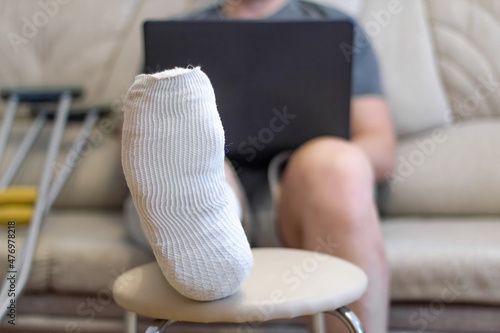 A man sits on a sofa in a cast with a laptop. A leg in a cast lies on a chair.