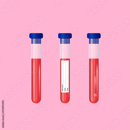 Test tube with blood and sticker