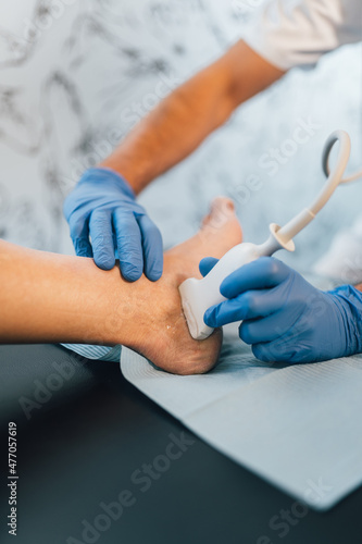 Close-up of a Chiropodist doing an ultrasound test to patient's foot.