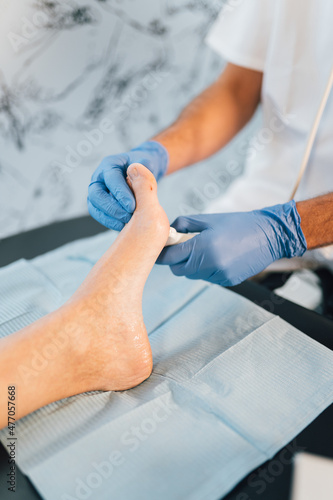 Close-up of a chiropodist doing an ultrasound test to patient's foot.