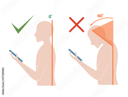 Computer neck syndrome