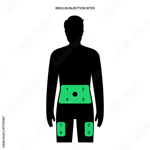 Insulin injection sites