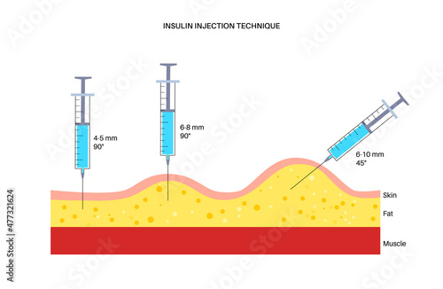 Insulin injection sites