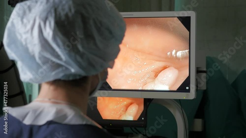 Monitor screen of endoscopy removal of polyp in intestine, Rear view of endoscopist surgeon doing endoscopic polypectomy