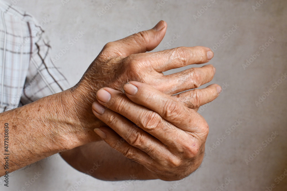 Fototapeta premium Asian man’s fingers and hand. Concept of hand pain, arthritis and finger problems.