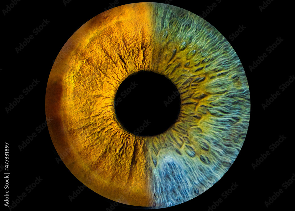 eye close-up. iris heterochromia, two-color iris with black background eye close-up. iris heterochromia, two-color iris with black background