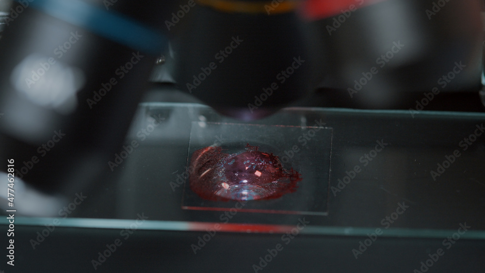 Microscope with optical lens examining blood sample in laboratory. Scientist using microscopic tool with magnifying glass and glassware to investigate dna test and genetic. Close up Microscope with optical lens examining blood sample in laboratory. Scientist using microscopic tool with magnifying glass and glassware to investigate dna test and genetic. Close up