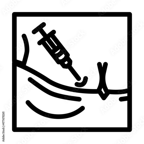 mesotherapy rejuvenation zones line icon vector. mesotherapy rejuvenation zones sign. isolated contour symbol black illustration