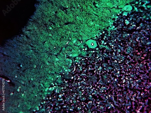 Purkinje cells cerebellum, histology microscopic view neurons photo