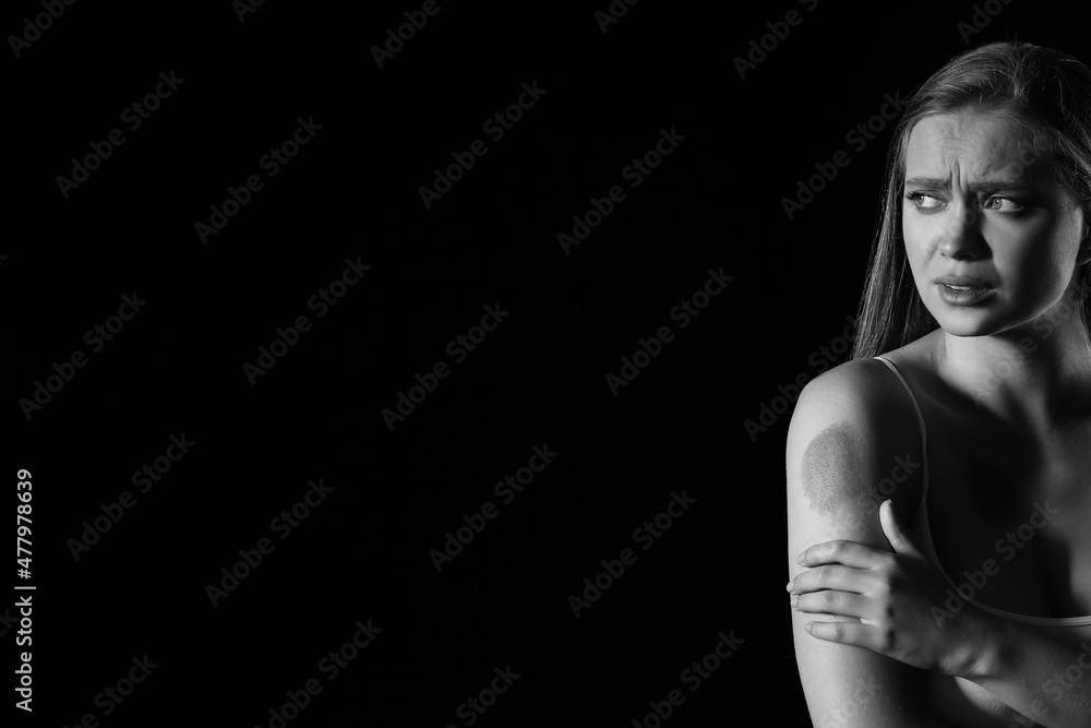 Scared woman with bruises on dark background. Violence concept Scared woman with bruises on dark background. Violence concept