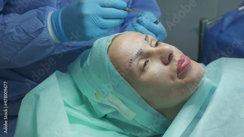 Plastic surgical operation for eyebrow correction. Woman patient is lying on the operation table, doctor applies stitches after surgery 
