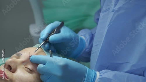 Plastic surgical operation for eyebrow correction. Woman patient is lying on the operation table, doctor applies stitches after surgery 