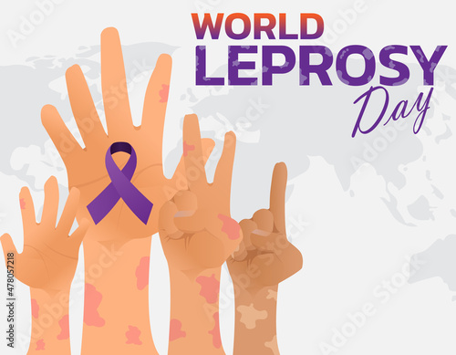 Vector illustration on the theme of World Leprosy Day in January