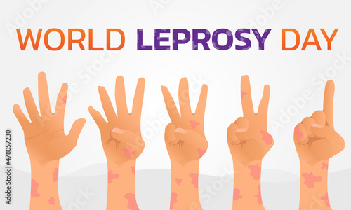 Vector illustration on the theme of World Leprosy Day in January