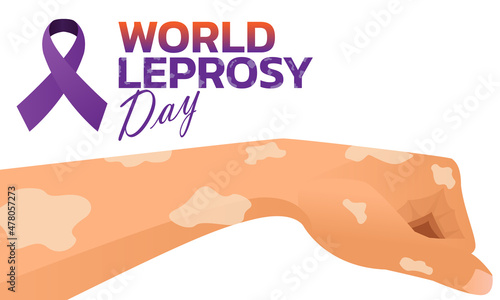 Vector illustration on the theme of World Leprosy Day in January