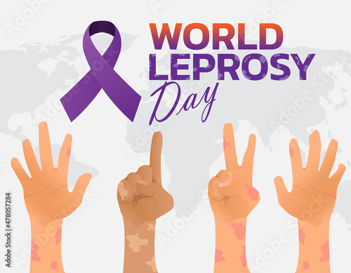 Vector illustration on the theme of World Leprosy Day in January
