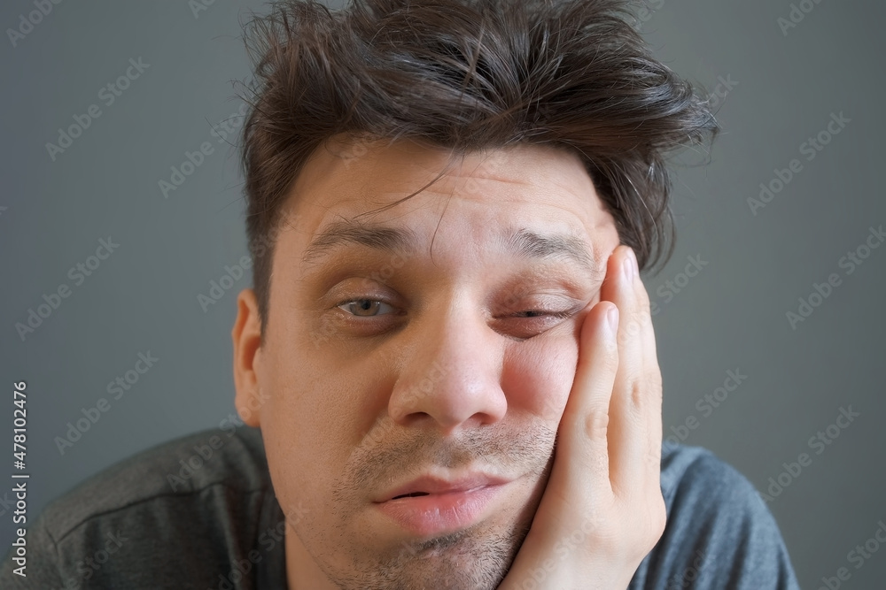 Tired boring shaggy young man is looking at camera on grey background. He is keeping his head by hands. Depression, apathy, and mental illness in the modern world. Middle age crisis. Tired boring shaggy young man is looking at camera on grey background. He is keeping his head by hands. Depression, apathy, and mental illness in the modern world. Middle age crisis.
