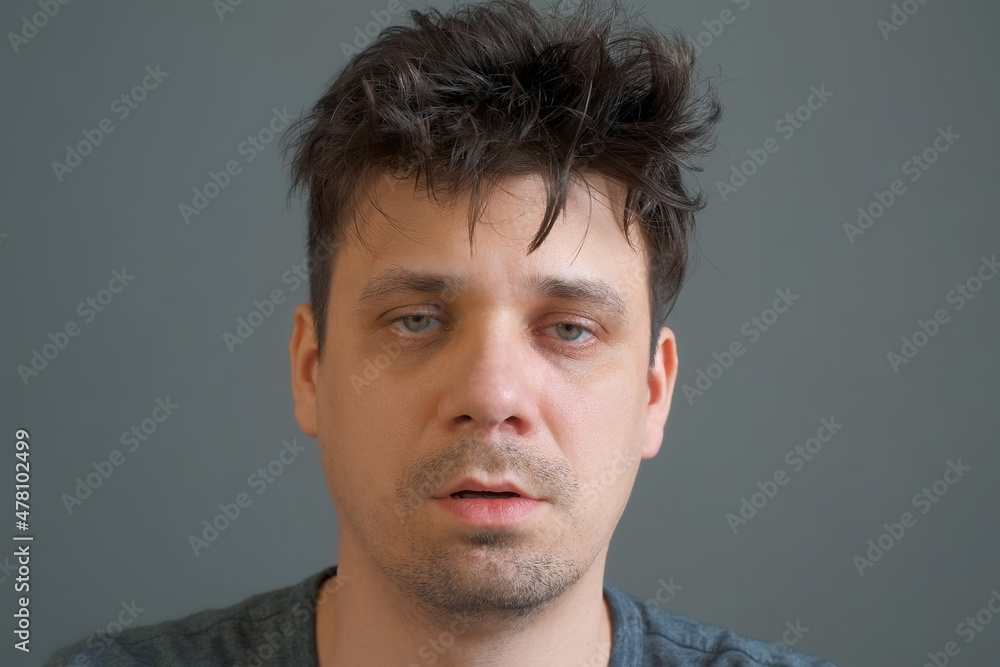 Fototapeta premium Tired boring shaggy young man is looking at camera on grey background. He is keeping his head by hands. Depression, apathy, and mental illness in the modern world. Middle age crisis.
