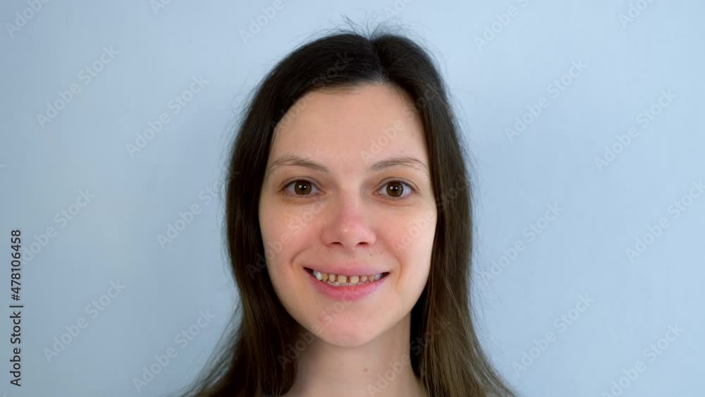 Portrait of woman with yellow bad teeth is smiling and looking at camera. Teeth sharpened by a dentist before installing crowns and ceramic veneers. Dentistry treatment, prosthetics of teeth concept. Portrait of woman with yellow bad teeth is smiling and looking at camera. Teeth sharpened by a dentist before installing crowns and ceramic veneers. Dentistry treatment, prosthetics of teeth concept.