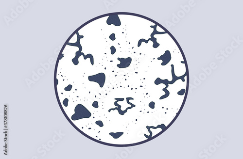 Black fungus mildew. Mold on a damp wall or in a damp room. Infection, microbe or toxic element. A black spot with the texture of a fungus. Inflammatory process, bacteria, spores or bacilli. Vector