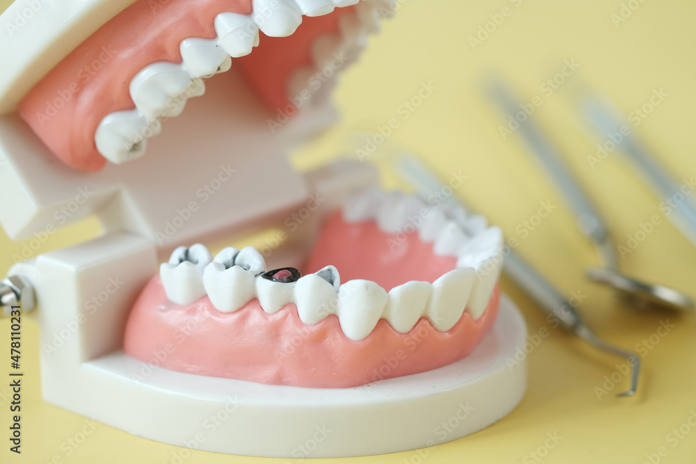 Fototapeta premium plastic dental teeth model on white background 