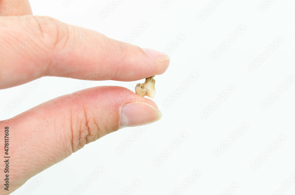 A cat's tooth fell out from a dental chamber in hands on a white background