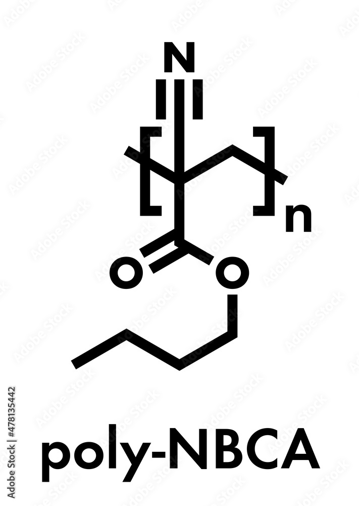 Poly(n-butyl cyanoacrylate) polymer, chemical structure. Polymerized (set) form of n-butyl cyanoacrylate medical instant glue. Used for medical and veterinary wound closure. Skeletal formula. Poly(n-butyl cyanoacrylate) polymer, chemical structure. Polymerized (set) form of n-butyl cyanoacrylate medical instant glue. Used for medical and veterinary wound closure. Skeletal formula.