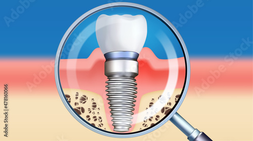 teeth with magnifying glass showing tooth in gums with roots visible. Realistic vector illustration .