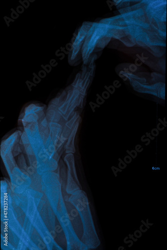 human hand under X-rays on black background