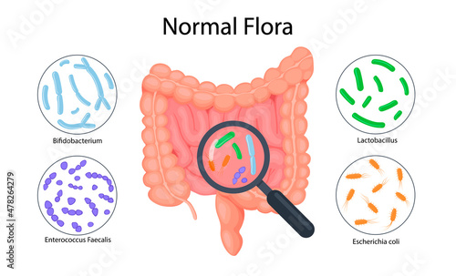 Intestine anatomy, intestinal microflora infographics. Good flora: Bifidobacterium, Enterococcus Faecalis, Lactobacillus, Escherichia Coli photo