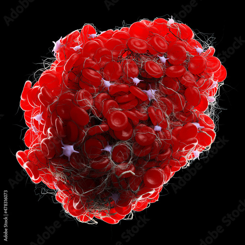 3d rendered illustration of a blood clot