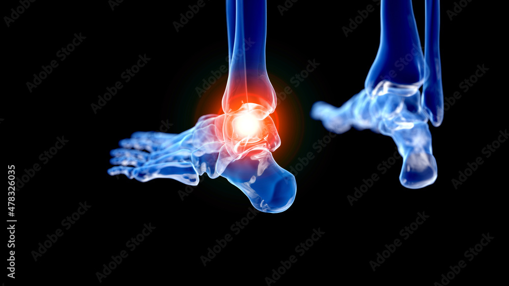 3d rendered illustration of a painful ankle 3d rendered illustration of a painful ankle