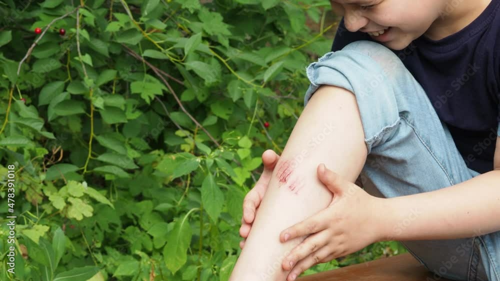 Closeup of injured young kid's knee after he fell down on pavement. the