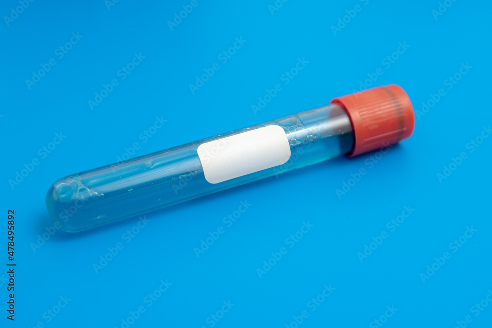 Test tube with empty label to biological sample for medical laboratory research on blue background Test tube with empty label to biological sample for medical laboratory research on blue background